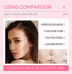 Japan Sakura Skincare Set – 6-Piece Radiant Glow Kit