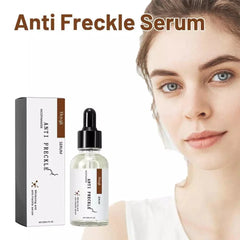 Anti-Freckle Serum - 30ml