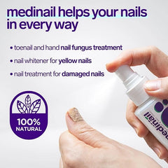 Jaysuing Nail Fungus Spray - Fast & Effective Treatment