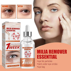 Smooth Milia Remover Serum - Clear & Hydrate Skin