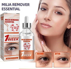 Smooth Milia Remover Serum - Clear & Hydrate Skin