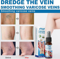 South Moon Varicose Veins Relief Serum - Soothe & Support